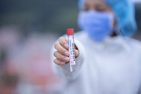 COVID-19 testing. A person in a PPE kit holds a test tube marked covid 19 test