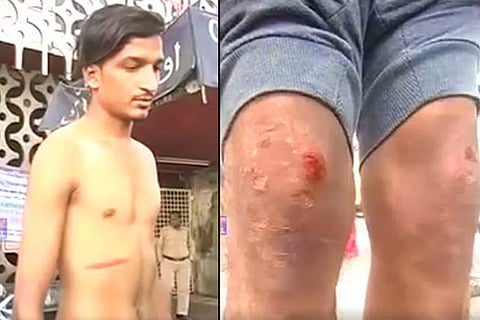 Hyderabad motorist, caught for not wearing helmet, allegedly assaulted by traffic cop