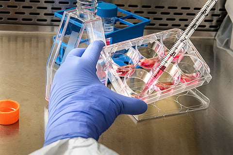 Lab test