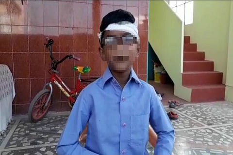 Hyd student injured on head after teacher allegedly hit him with aluminium rod