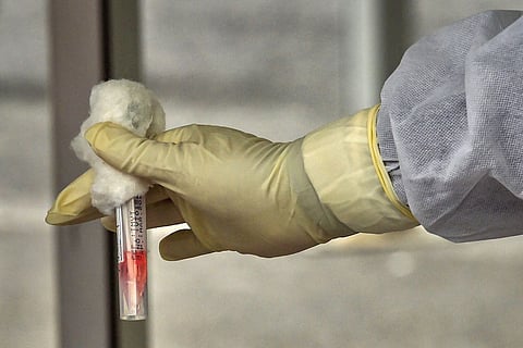 ICMR agreed to pay 2.5 times the price for rapid test kits, Delhi HC judgment shows