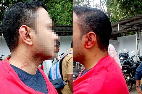Vinay who was attacked by a bus driver in Bengaluru is seen in a red shirt, his ear bleeding