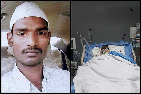 Hyderabad man allegedly set on fire by Saudi employer after dispute
