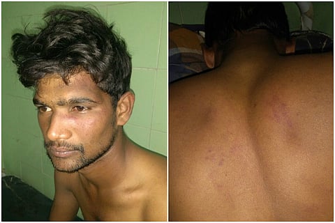 Cricket quarrel leads to casteist attack: Dalit youth assaulted in Andhra