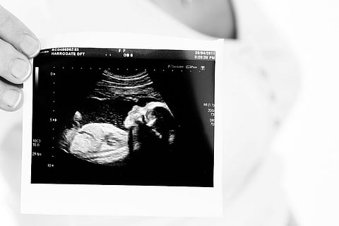 Gynaecologists and obstetricians lost a major SC battle: Here’s the judgement explained