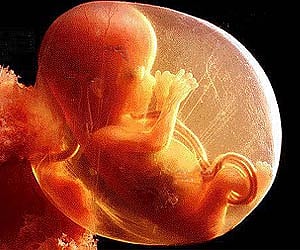 A 16-week-old foetus (Pic courtesy: Ismusurizan.com)