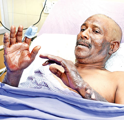 Five Injured in BDL Blast
