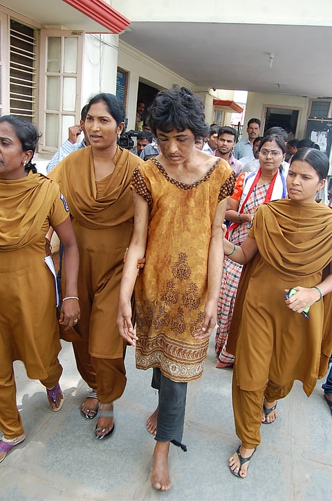 Girl Tortured by Father, Stepmother Rescued in Hyderabad