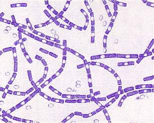 Two days after jumbo’s death,cattle vaccinated against anthrax