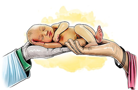 C-section at an alarming rise in Kerala