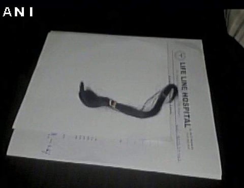 A picture of a cut braid. (File | Twitter/ANI)