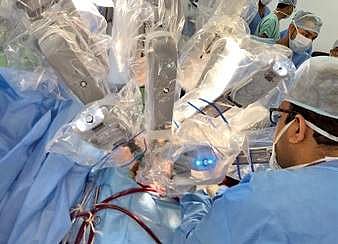 Robotic arms assist surgeons in mitral valve surgery. Image used for representation.