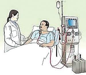 Gender disparity in Dialysis?