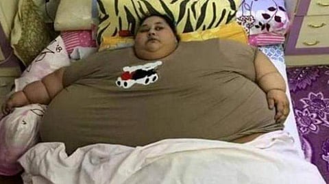 Eman Ahmed earlier weighed half-a-tonne and was regarded the world's fattest woman alive. (Courtesy: hotklop.blogspot.in)