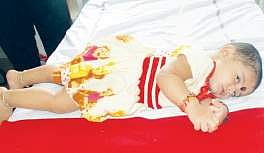 One year old Navya undergoing treatment in Guntur Government Hospital  | Express