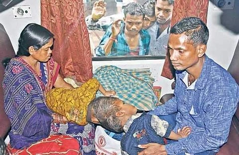 AIIMS doctors perform marathon brain surgery on Odisha conjoined twins; second operation to follow in weeks