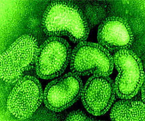 The H1N1 virus.