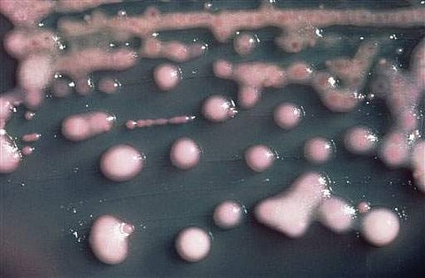 Bacteria image used for representational purpose only