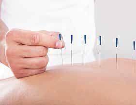 Acupuncture effective in managing acute pain