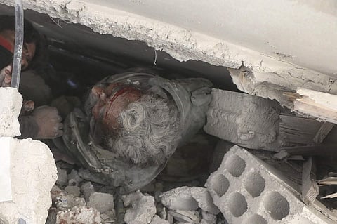 More than 200 civilians have been killed, among them 57 children. | AP