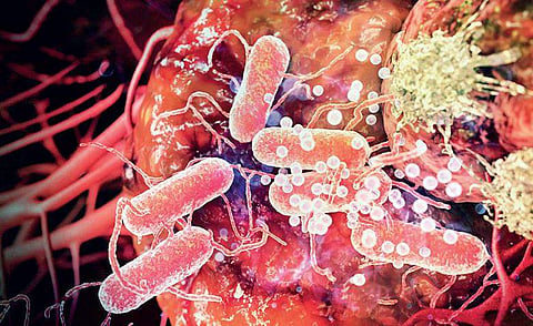 Did you know 60% of cancers are preventable