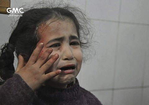 A Syrian young girl who was wounded during an airstrike. (File | AP)