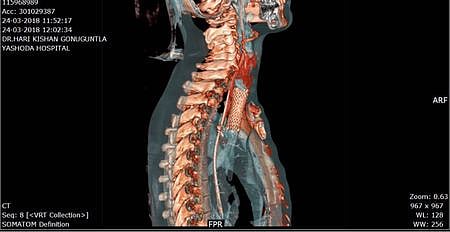 x-ray072158
