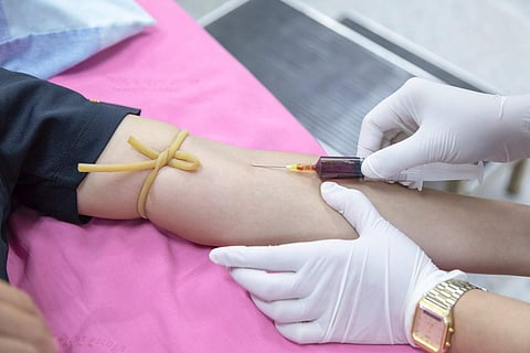 BLOOD DONATION. Image for representation.