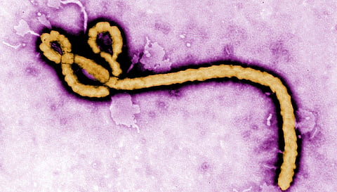 This undated colorized transmission electron micrograph image made available by the Centers for Disease Control and Prevention shows an Ebola virion. 