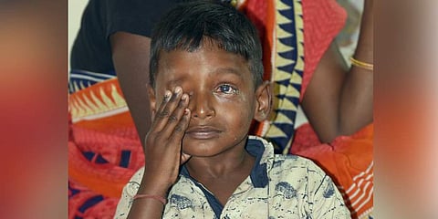 Six-year-old Venkatesh was blinded in one eye when a cracker burst outside his house. (Photo |  Nagaraja Gadekal, EPS)