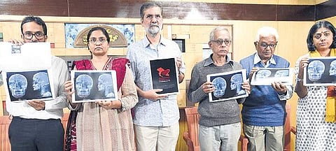 Filmmaker Sanjay Kak, advocates Aarti Mundkur and Clifton D Rozario, Nagari Babaiah of People’s Democratic Forum and others hold up X-rays of Kashmiris who were shot with pellets, in Bengaluru on Thursday  | Nagaraja Gadekal