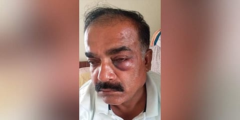 Gang assaults man after promising him lift 