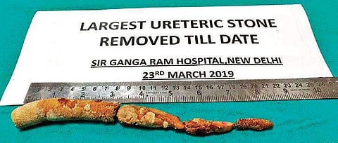 Authorities claim the stone is the longest till date | EPS