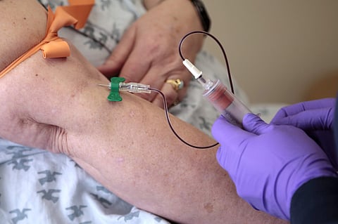 Image of a blood test used for representational purpose (File Photo | AP)