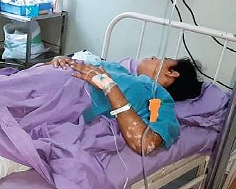 Shaheen Taj,  the bride-to-be, had to amputate her left leg after she fell into an unattended pit. (Photo | EPS)