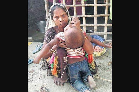 Reena Devi, who lost two children to  AES, with her surviving son. (Photo | EPS)