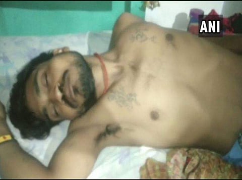 Raj Kumar's family cremated the snake to 'atone' for their son's 'sin' of having killed the snake. (Photo | ANI)