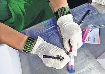 A health worker marks a vial carrying a sample, collected for RT-PCR test, in Bengaluru on Sunday | shriRam BN