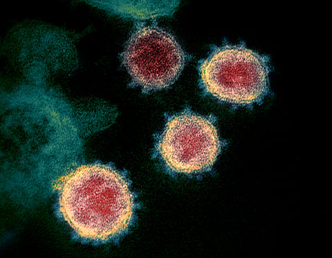 The spikes on the outer edge of its surface is what gives the coronavirus its name, crown-like. (Photo | NIAID - RML)