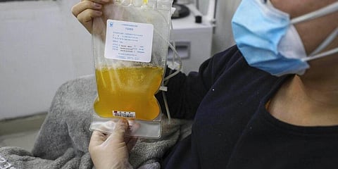 Plasma (Photo | AP)