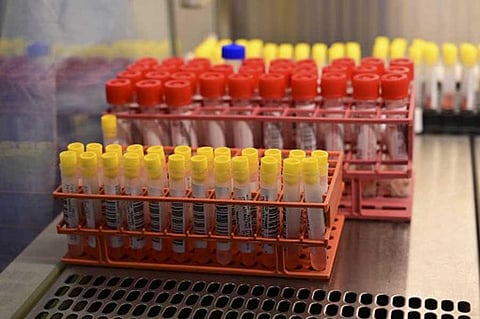 Microbiology laboratory of the Circolo di Varese hospital shows samples of the novel coronavirus. (File Photo | AFP)