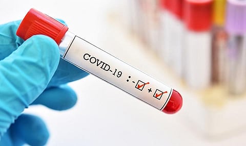 Kochi firm to manufacture Covid test kits