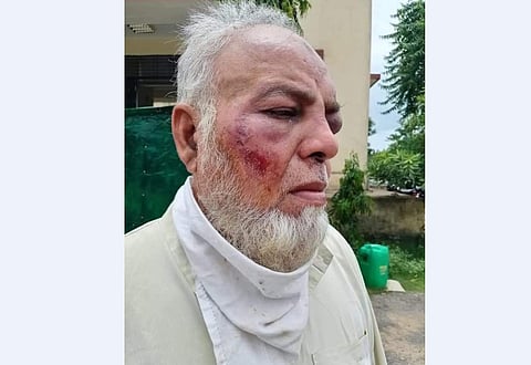 In the FIR, Gaffar Ahmed said that the men assaulted him when he refused to comply with their diktat. (Photo | EPS)