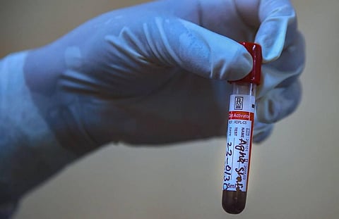 A blood test sample for COVID-19 (File Photo)