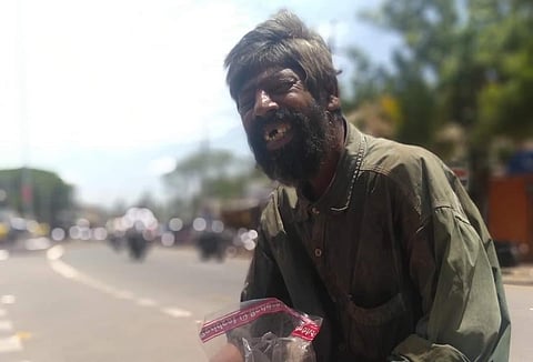 Basappa alias Huccha Bashya from Hoovina Hadagali Taluk sits near the bus stand. (Photo | EPS)