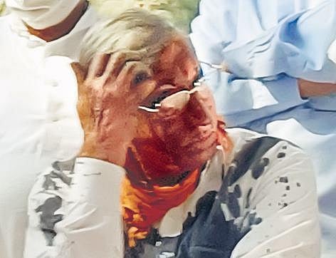 Maharashtra Ekikaran Samiti leader’s face blackened during Belagavi meet 