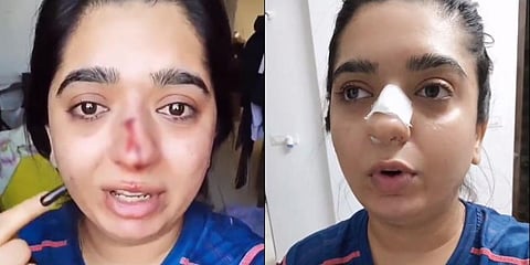 Instagram beauty influencer Hitesha Chandranee who was assaulted by a Zomato delivery boy (Photo | Instagram screengrabs)