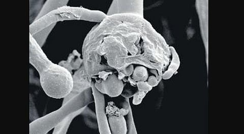 A magnified scan of Black fungus