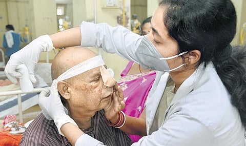 A doctor treats a patient infected with mucormycosis at the NSCB Medical College and Hospital in Jabalpur, Madhya Pradesh, on Friday | PTI
