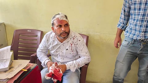 An injured member of the motivators' team (Photo | Special arrangement)